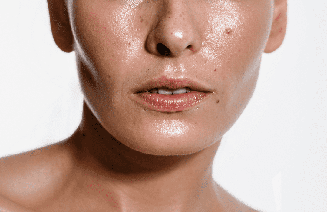 Skincare for Oily Skin: Achieve a Glowing Complexion without Greasiness!