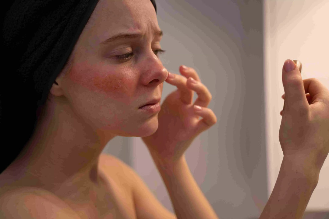 4 Characteristics of Sensitive Skin and How to Care for It