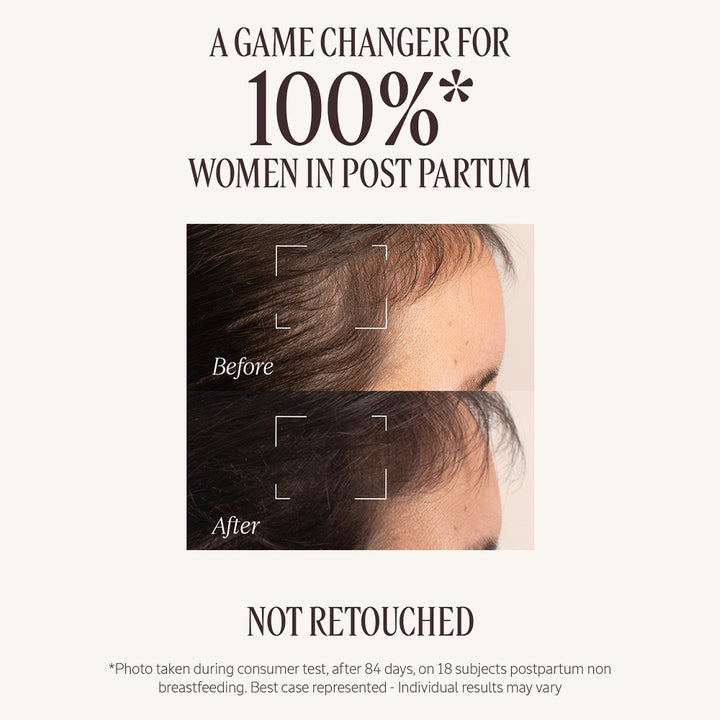 Anti-Hair Loss Treatment 50ml