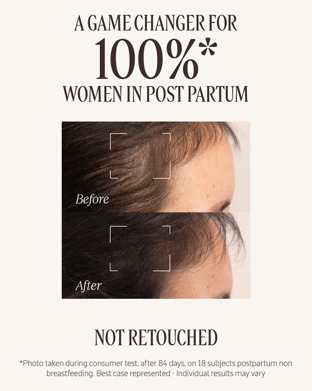 Anti-Hair Loss Treatment 50ml