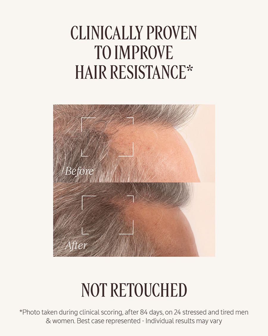Anti-Hair Loss Treatment 50ml