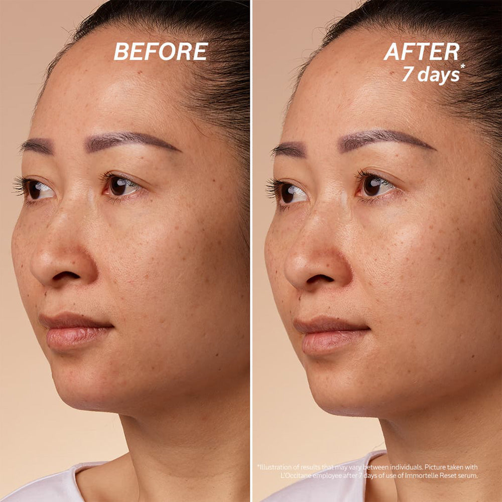 Lunar New Year Set - Reset Oil in Serum